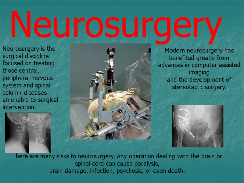 Neurosurgery  Neurosurgery is the surgical discipline focused on treating those central, peripheral nervous